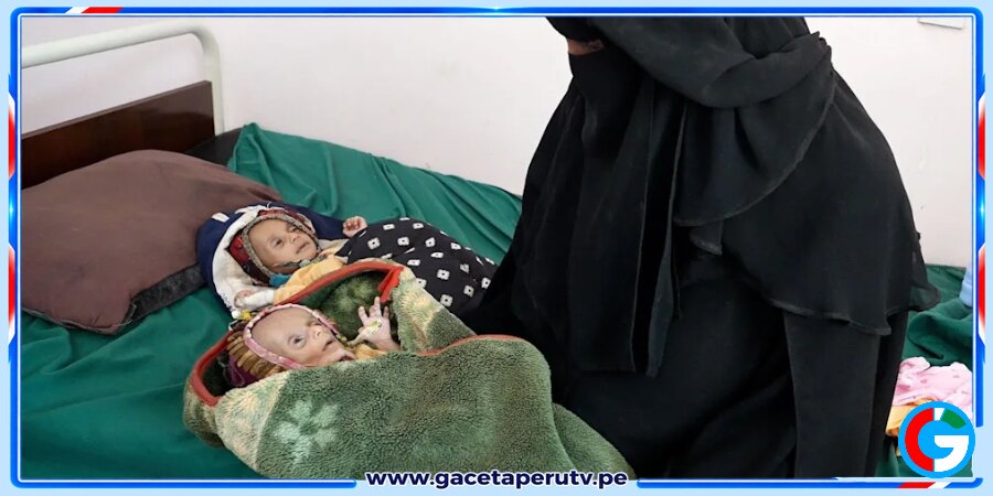 Gemelos recién nacidos luchan por sobrevivir al hambre y la guerra en Yemen