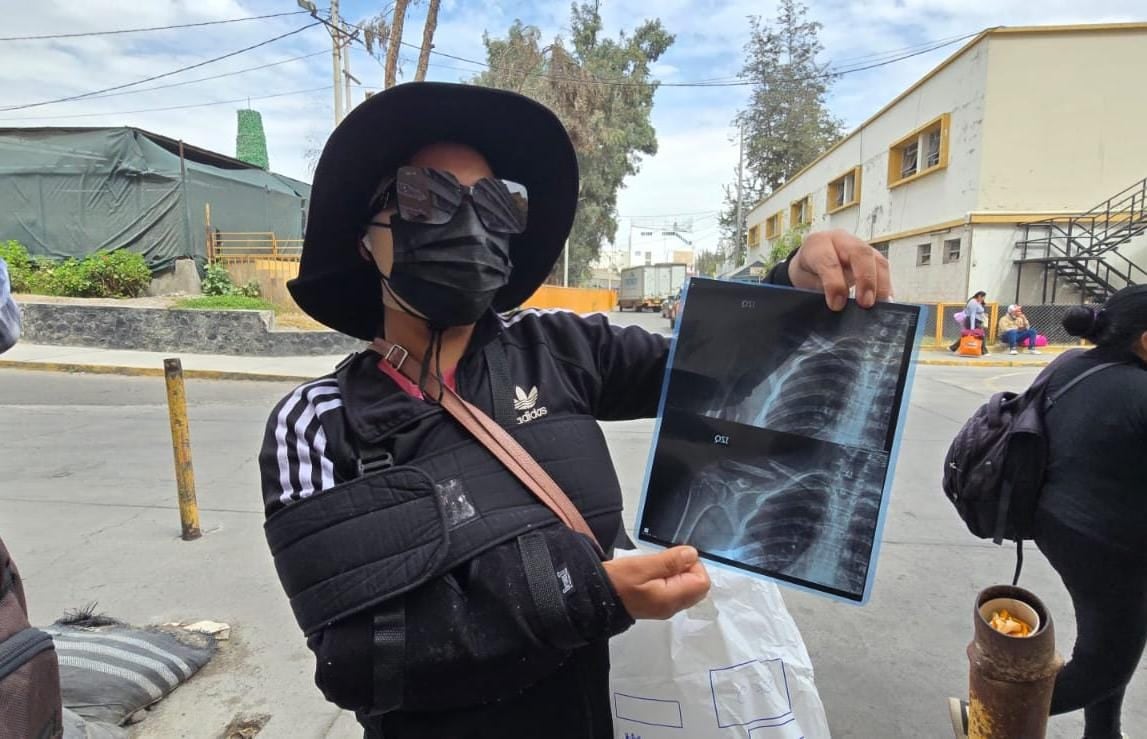 Madre sobreviviente al ataque en Majes pide ayuda para costear tratamiento de sus hijos (VIDEO)