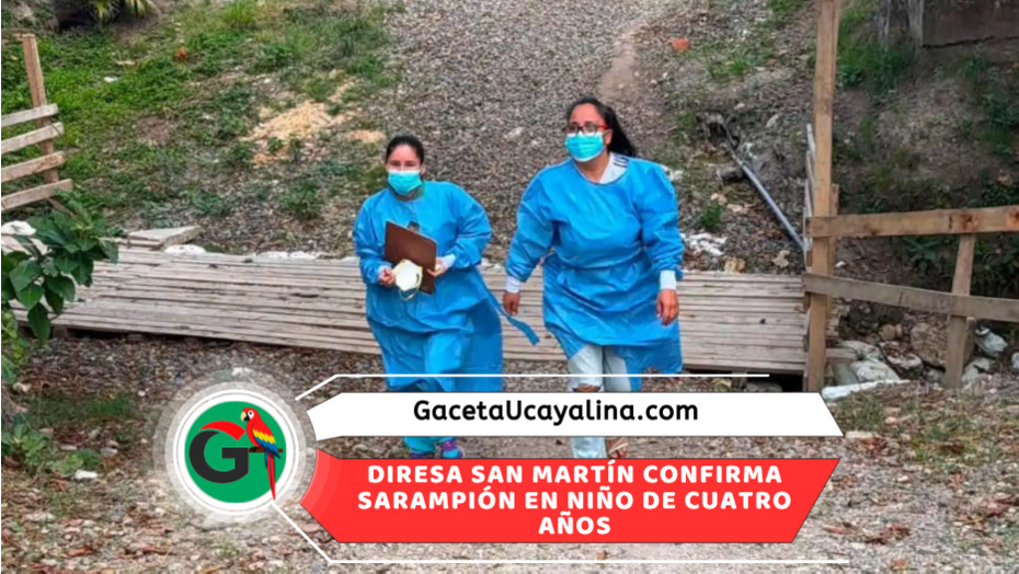 San Martín confirma primer caso de sarampión y activa operativo sanitario
