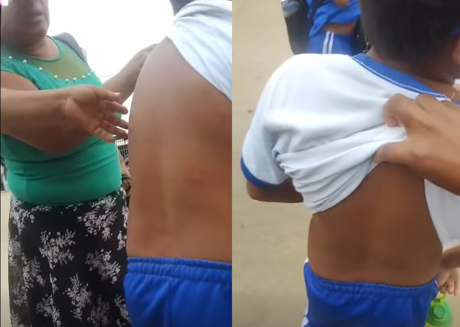 Piura: Colegiales sufren por picaduras de pulgas en Sullana