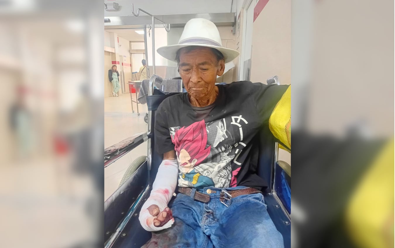 Arequipa: Buscan a familiares de anciano herido tras accidente