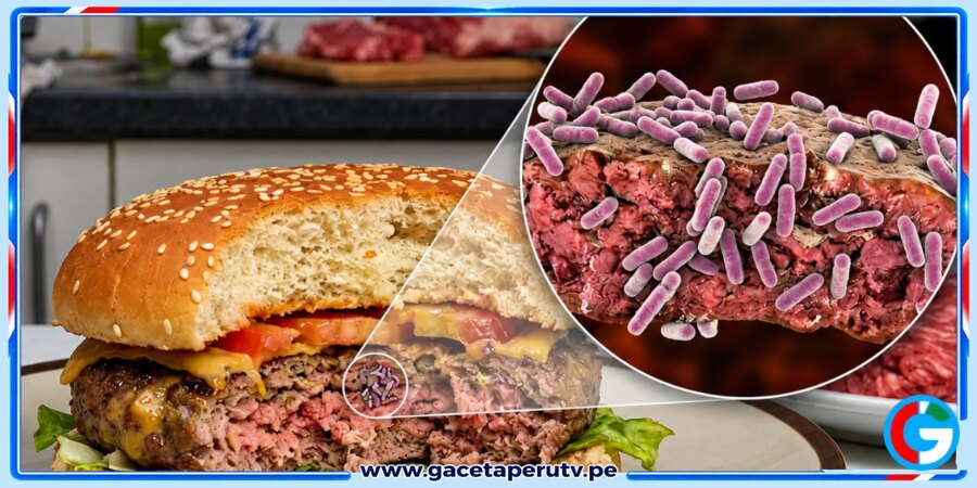 Ate: Veinticinco afectados tras consumir productos en local de comida rápida